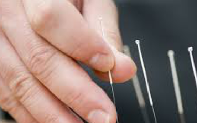 The Difference Between Acupuncture and Dry Needling