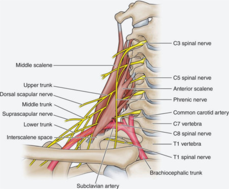 Pinched Nerve From a Car Accident