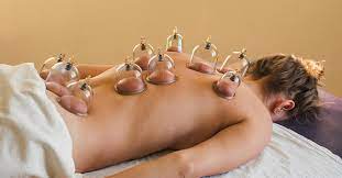 Benefits of Cupping Therapy - Pro Chiropractic