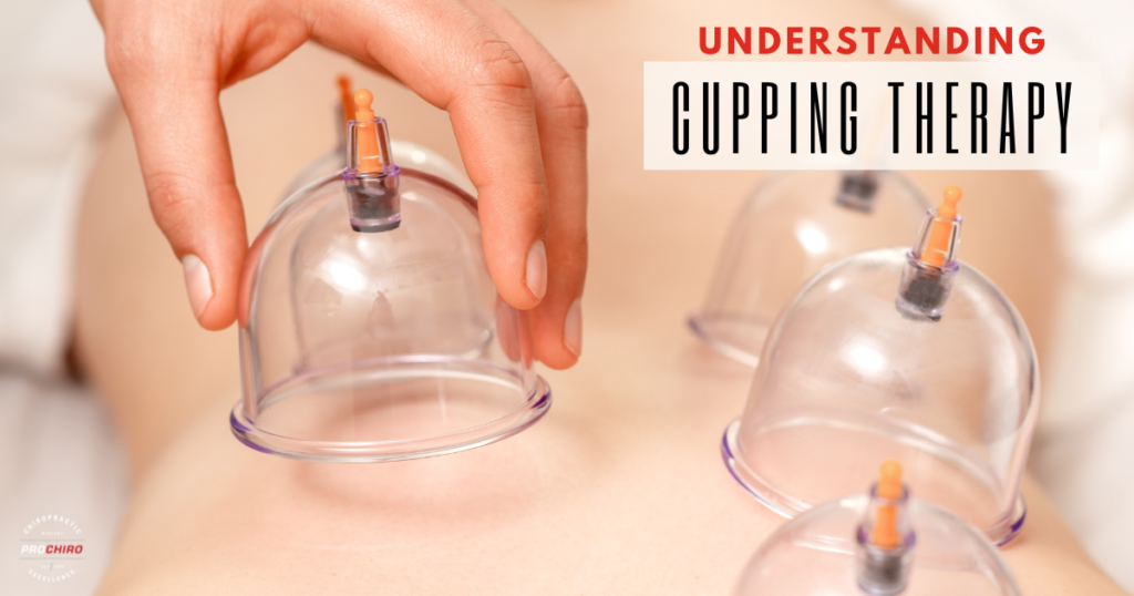 Cupping Therapy in Bozeman, MT