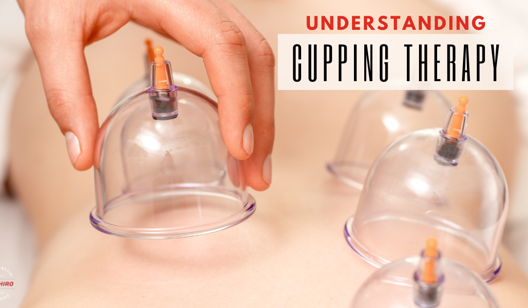 Unlock the Power of Cupping Therapy in Bozeman, MT