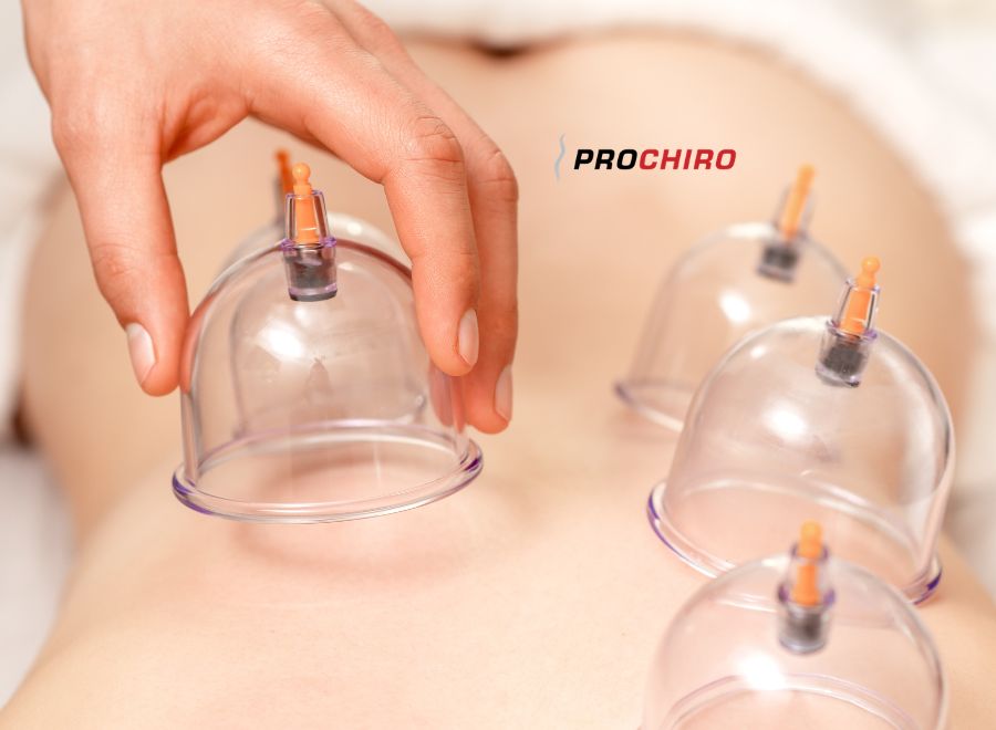 Cupping Therapy Bozeman