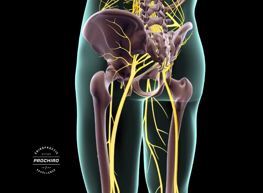 Sciatica Treatment in Bozeman - ProChiro Bozeman, MT